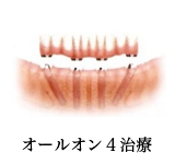 オールオン４